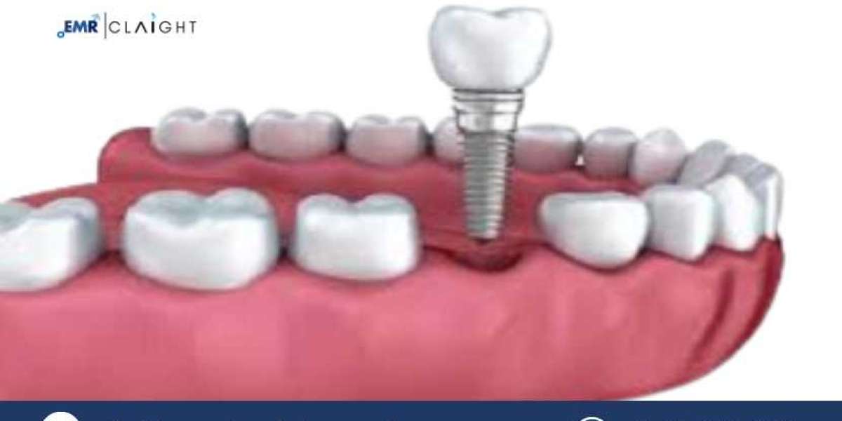 Global Aesthetic Implants Market: Size, Share & Industry Overview, 2025–2034